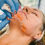 PDO THREAD | AIYANA Aesthetics